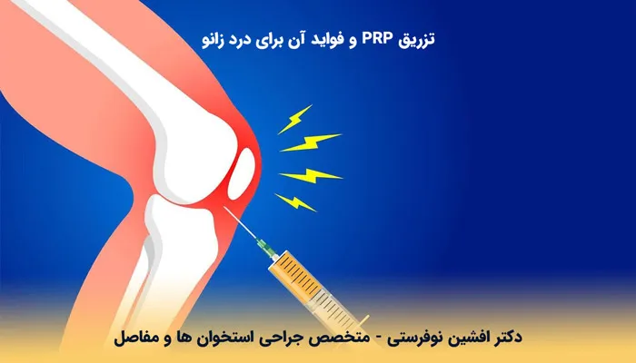 درمان مفصل زانو با تزریق پی آر پی