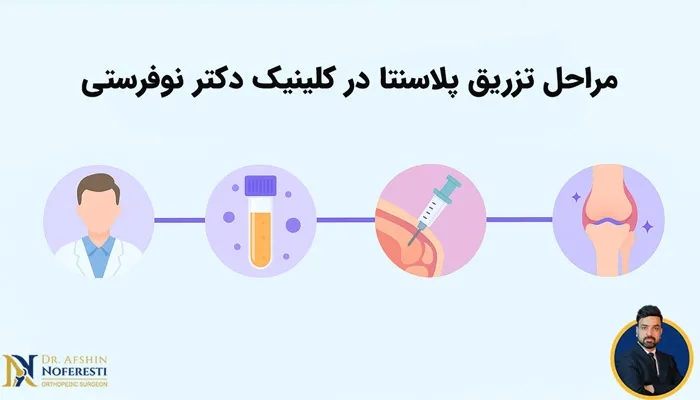 مراحل انجام تزریق پلاسنتا