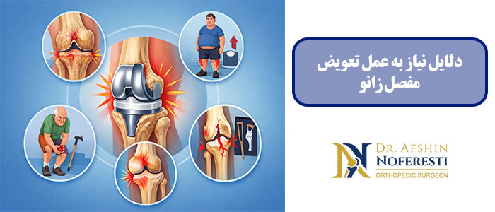 دلایل نیاز به عمل تعویض مفصل زانو