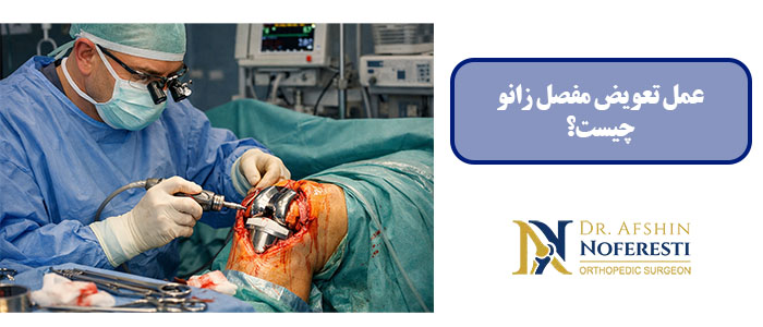 عمل تعویض مفصل زانو چیست؟