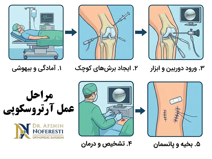 مراحل عمل آرتروسکوپی