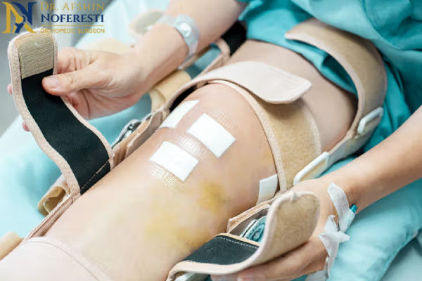 اقدامات بعد از تعویض مفصل زانو