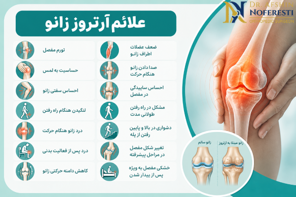 علائم آرتروز زانو